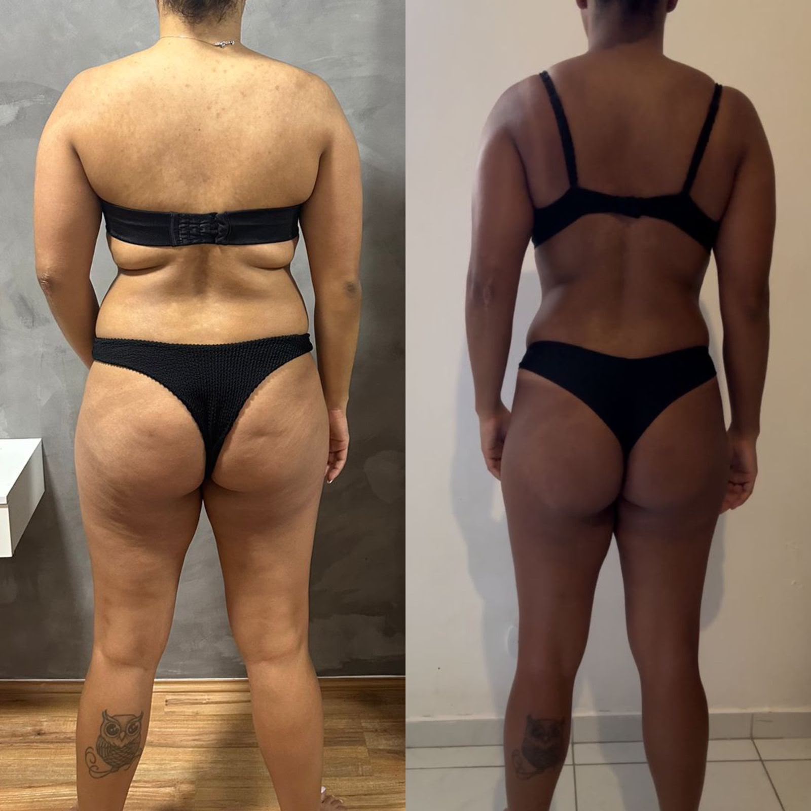 Resultado antes e depois 3